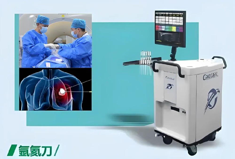 58岁肝癌患者拒绝开腹手术，这项冰火“双术”让他3天出院